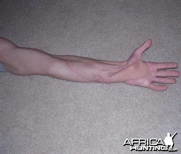 List 90+ Pictures puff adder bite wounds pictures Excellent