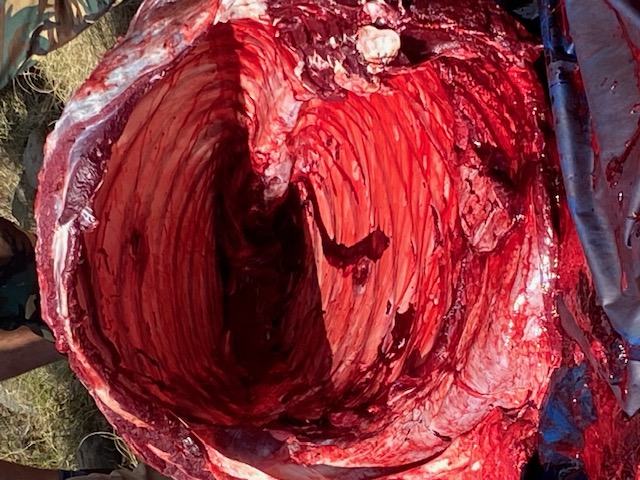Buff Cavity Lung etc  Removes.jpg
