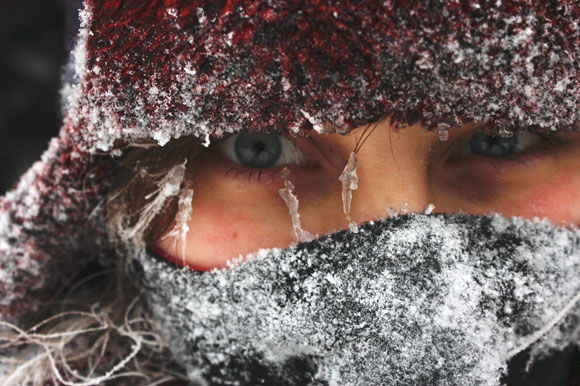 Frostbite-Cold_shutterstock-resized-600.jpg.png