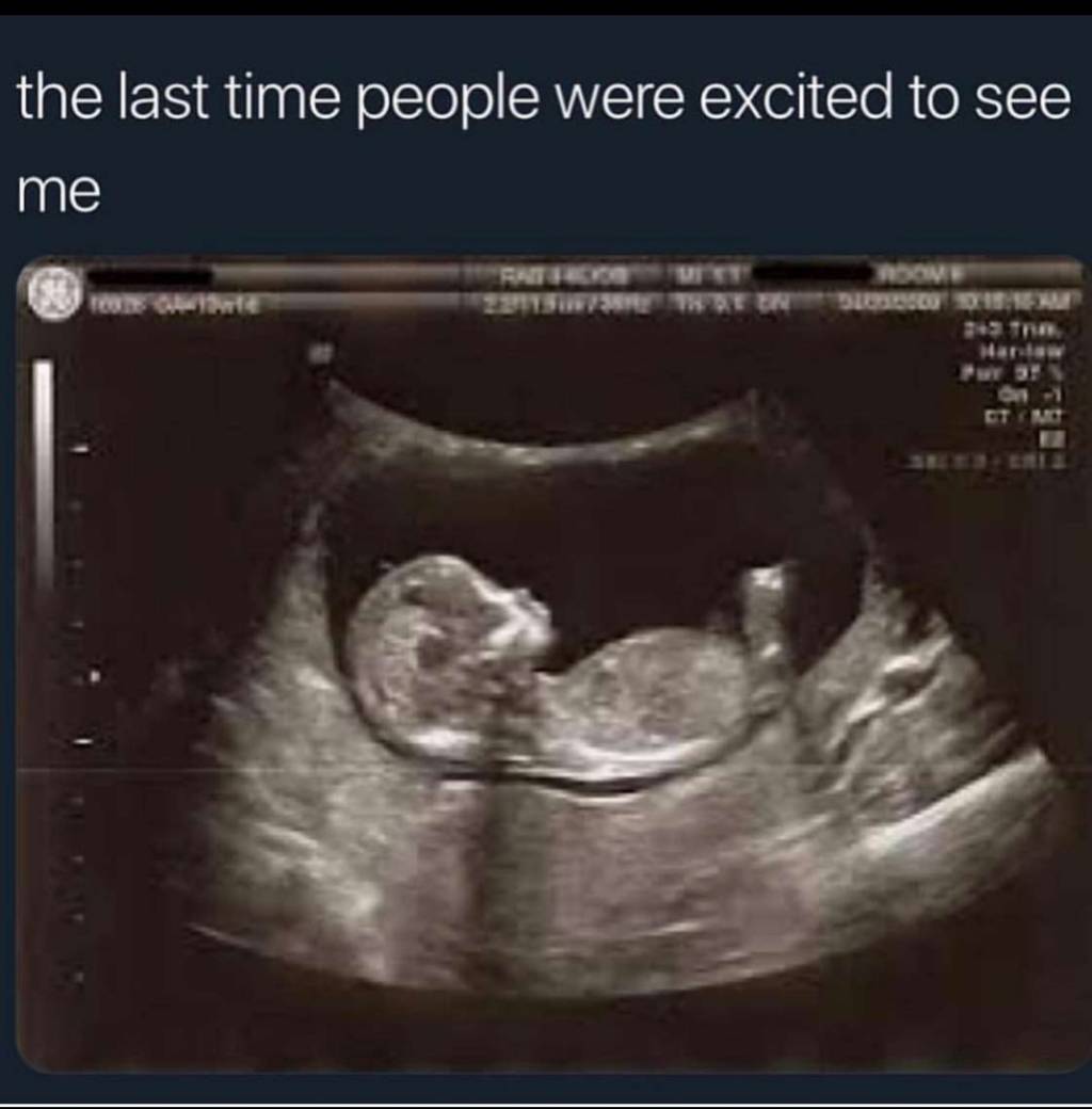 Screenshot_20181106-163305_Snapchat.jpeg