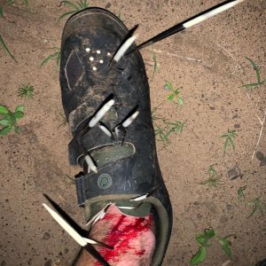 Porcupine Attack KwaZulu Natal South Africa