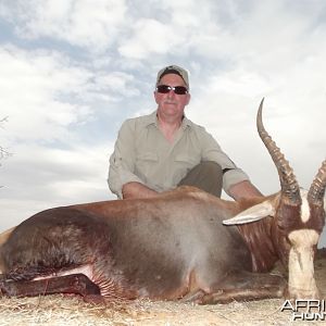 Blesbok hunt with Wintershoek Johnny Vivier Safaris