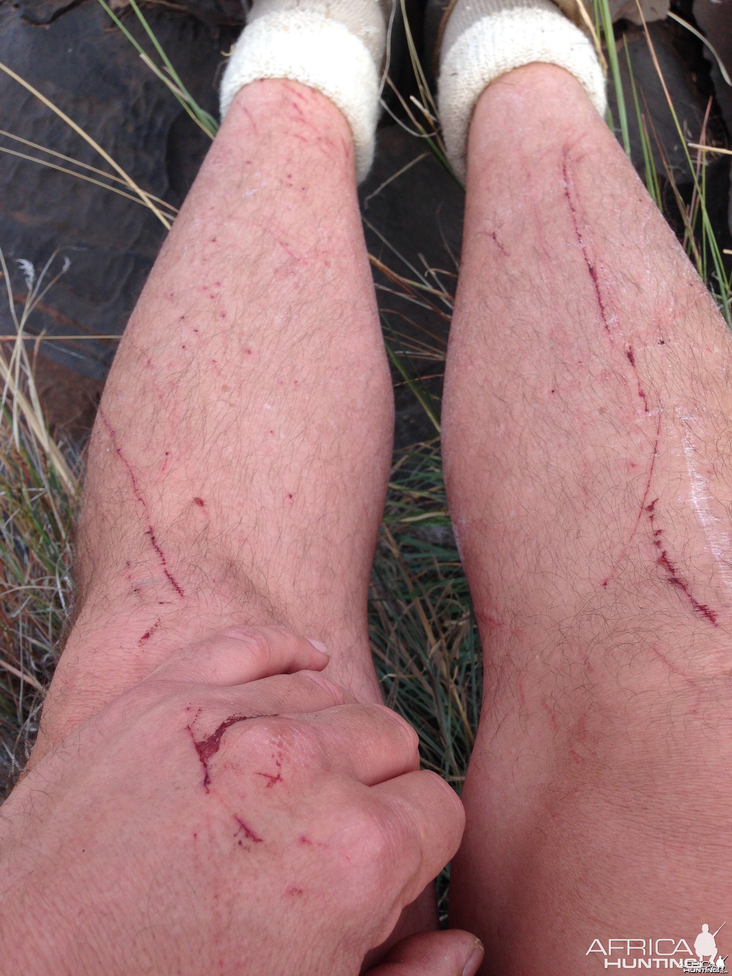 My Legs After A Day Of Barbary Sheep Hunting